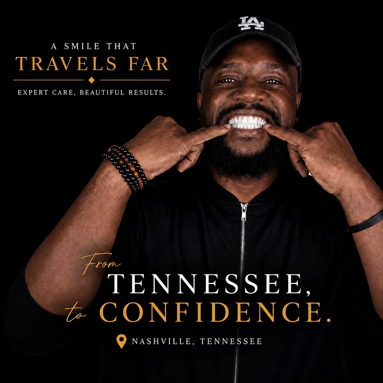 African American patient before/after porcelain veneers